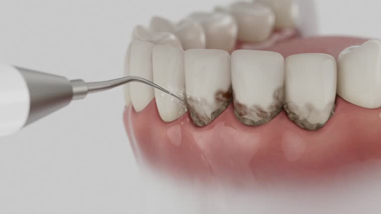 Trusted Root Canal Treatment service in Leo-Cedarville, IN - Dentist Open Now